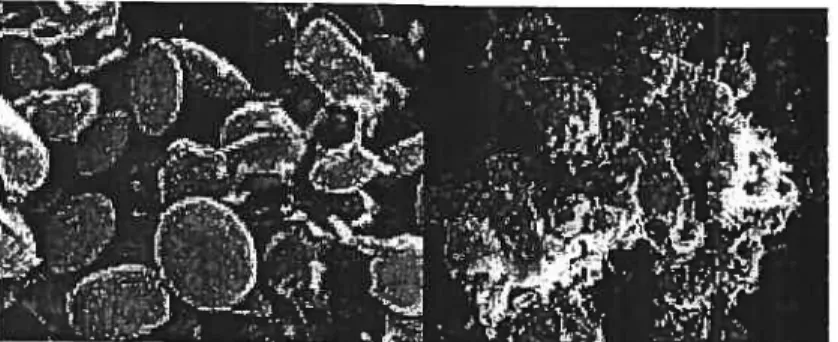 Figure 3: Représentation de l’adhésion des plaquettes et des neutrophiles au niveau de l’endothélîum activé.