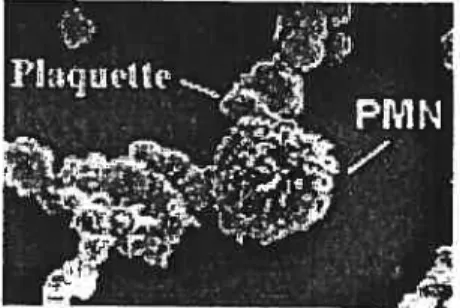 Figure 5: Image par microscopie électronique à balayage de la formation des hétéroagrégats