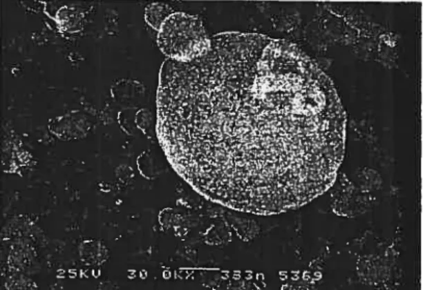 figure 10: Cette image prise par microscopie ectronique (Ctyo-F_ M) représente une plaquette