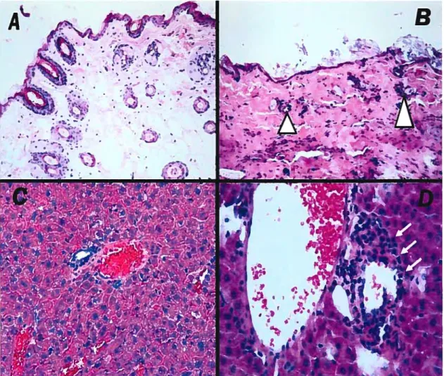 Figure 9 : Coupes histologiques comparatives de la peau et du foie de souris syngéniques et GVHDc