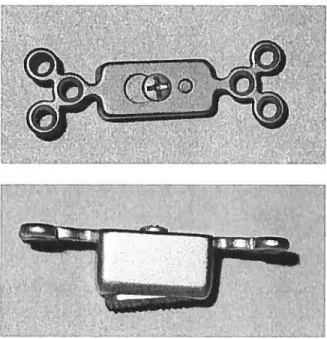Fig. 1. Laryngeal titanium implant shape