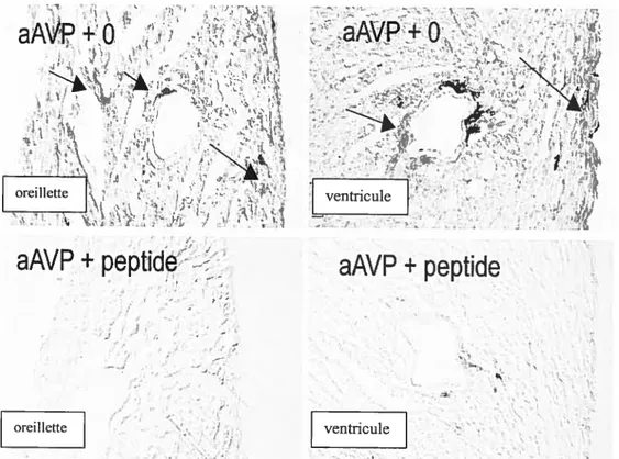 fig. 6: Démonstration immunocytochirnique de la présence de vasopressine dans les oreillettes et ventricules de coeur de rat de 22 jours