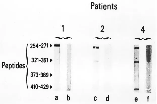 Figure 1. Patients’ sera were tested using the siot-blot technique against synthetïc peptides representing linear antigenic sites, before (a, c and e) and after (b, U and f) absorption with human liver microsomal proteins