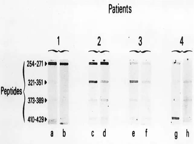 Figure 2. Patients’ sera were tested using the siot-blot technique before ta, c, e and g) and after (b, U, f and h) absorption with different peptides.
