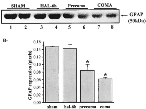 Figure 3. GFAP protein expression in the brains of rats with acute liver failure. A- Proteins were extracted from the frontal cortex of rats at different time points following hepatic artery ligation (HAL) and probed by western blot with a polyclonal antib