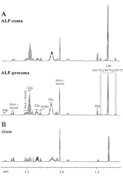 Figure 1: 1H-NMR spectra cf brain extracts.