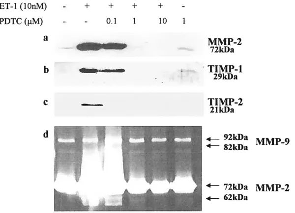 Figure 6 ET-1 (lOnM) PDTC (p.M) a b - + + + +-0.11 10 MMP-272kDa TIMP-1 29kDa TIMP-2 21 kDa — 92kDa d— $2kDaCd MMP-9 MMP-24—72kDa — 62kDa