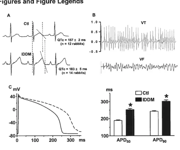 Figure 1. Electrical disorders in rabbits with insulin-dependent diabetes mellitus (IDDM).