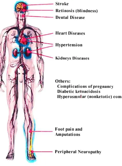 Figure 1. Diabetic Complications. (Moditied from healthcentersonhin.com)