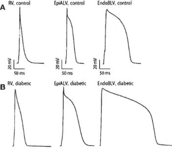 Figure 6. Action potentials of rat ventricles. APDs of three selected regions of the ventricular muscle recorded in diabetes (B) are remarkably longer than in control (A)