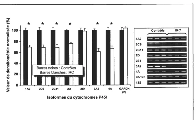 Figure 2 Expression de l’ARN messager codant pour les différentes isoformes du cytochrome P450 et de la GAPPU dans des hépatocytes normaux de rats après incubation dans du sérum constitué à 10% de sérum provenant de sujets humains avec IRC1 comparé à des témoins incubés dans du sérum constitué de sérum provenant de sujets humains sans IRC