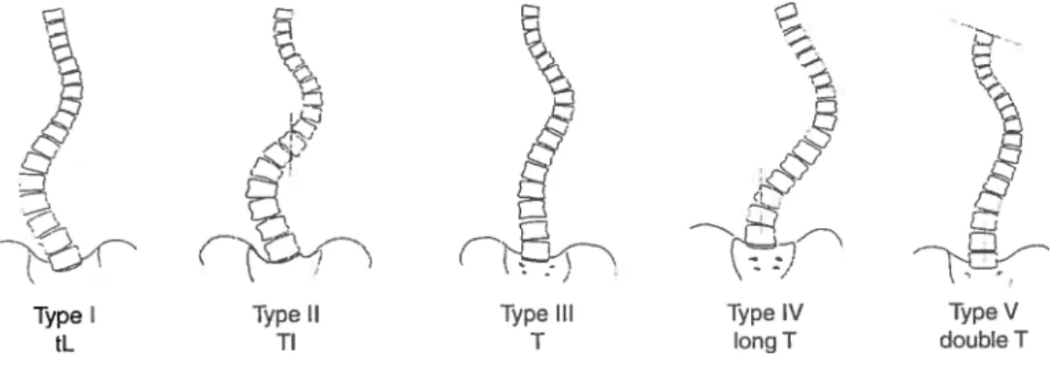 Figure 5: Classification de King