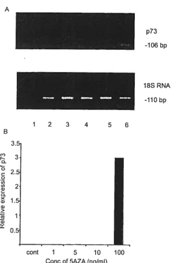 figure 1. Effect ofd,fferent concentrations of5AZA on the activation of