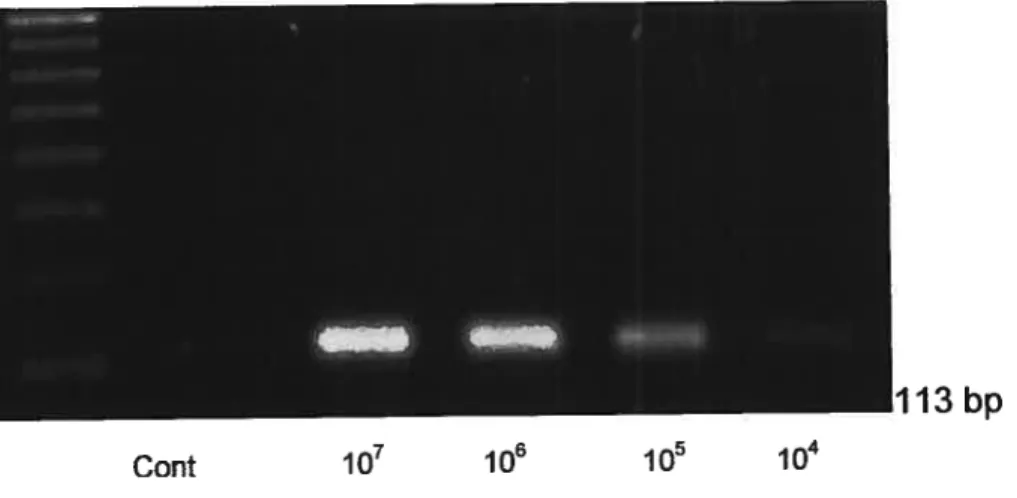 Figure 15.1: Electrophoresis of the p15 standard curve. PCR reaction for p15. The PCR were performed with the same conditions as those used in the study of this candidate gene but on a known amount of molecules of p15