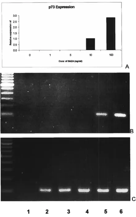 Fig 15.3 Effect of different concentrations of 5AZA on the activation of p73 expression in KG1a using a second set of primers