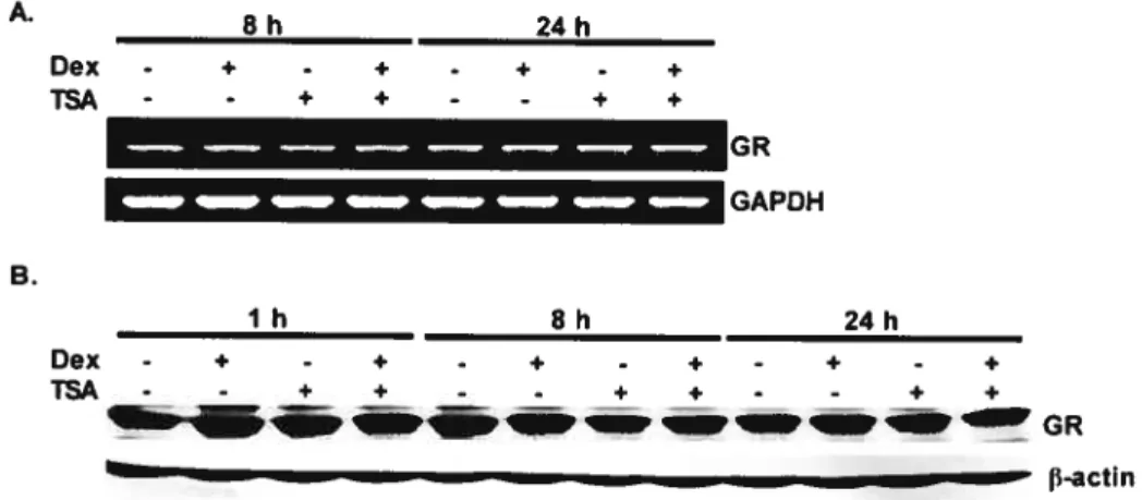 figure 7. HDACi do flot increase glucocorticoid receptor expression in Ishikawa ceils.