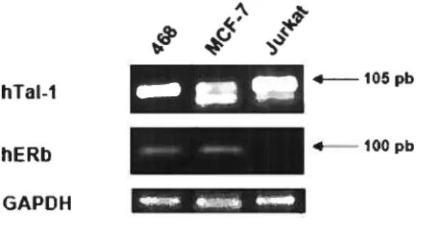 figure 5: L’ARNm de Tal-1 est exprimé dans les cellules MCF-7 et MDA-MB-46$.