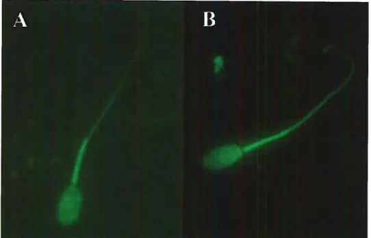 Figure 8: Profil de CTC des spermatozoïdes épididymaires porcins. (A) Spermatozoïde n’ayant pas subi la réaction de l’acrosome