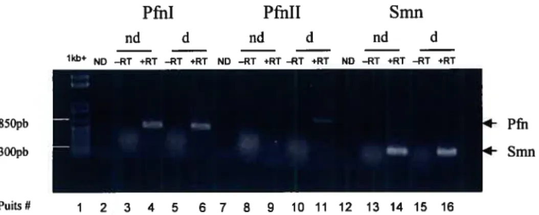 Figure 9. Expression de profihine dans les cellules P19. Amplification de PfnI, PfnII et Smn, par RT-PCR, à partir de l’ARN extrait des cellules P19  non-différenciées (nd) ou non-différenciées (d)