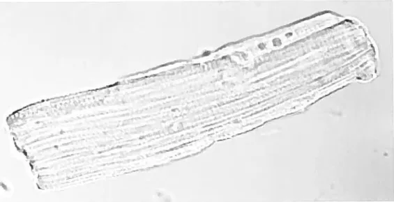 Figure 5 : Photo en microscopie confocale d’un cardiomyocyte.