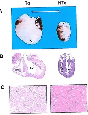 Figure 2 Comparaison entre un coeur transgénique surexprimant le Œ1B-AR et un coeur