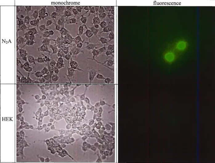 figure 3.4 — Contrôle de transfection I expression de l’EPN via le IRES-eGFP