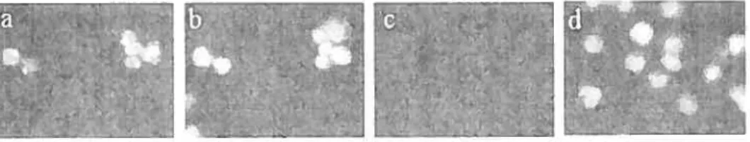 Figure 6: Detection ofNK-JR in Jurkat cetis by immunofluorescence. (a) NK-1R staining and (b) nucÏei staining in the same celi preparation
