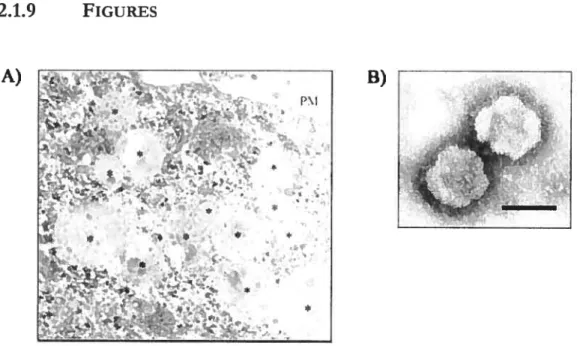 Figure 11. HeLa CIITA ceils possess multivesicular bodies and secrete exosomes.