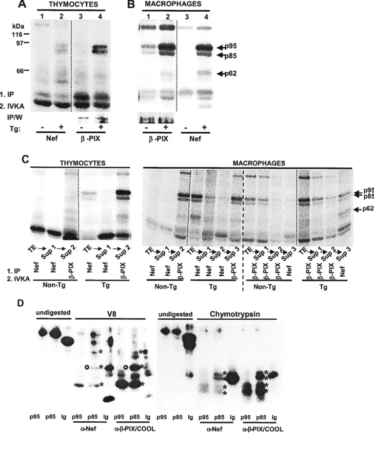 Figure 3kDa116—97—661.IP2. IVKAIPIw1 23 4 I—w3H. I 23 4_ø.1I —Ili-+-+f3-PIXNefTg:-+-+Nef3-PIXC MACROPHAGES -‘-p95lp85p62-.cq,%&gt;•4--ee—tIPZZQ.2.IVKANon-TgDundigested4c—,%_icc&gt;.--ee—ZZoTgj%%q’Lrn%%rn4_xII---Tg:Non-1gTgIeeZZNon-1gV8undigestedChymotrypsin (Vincent et ai)