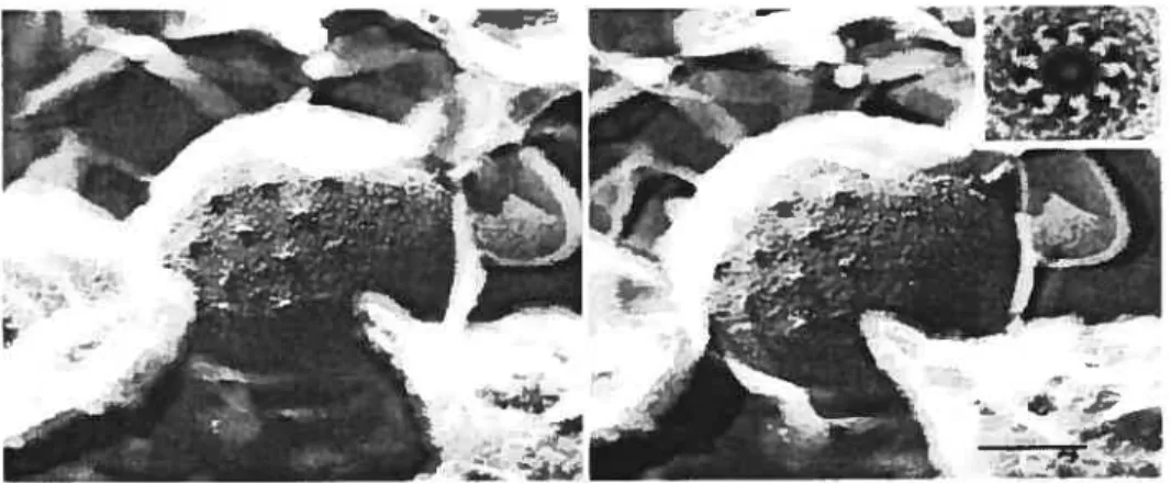 Figure 5. Surface projections of Chlamydia psittaci elementary body.