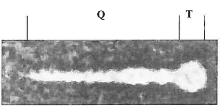 Figure 4. Microscopie électronique de la protéine al de réovirus. Q : Queue, T: Tête (adaptée de : Fraser, 1990).