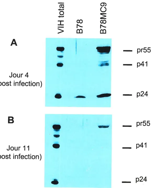Figure 3 Niveau d’expression des protéines Gag VIH-1 dans la cellule hybride B78MC9 infectée par le VSV-G/NL4