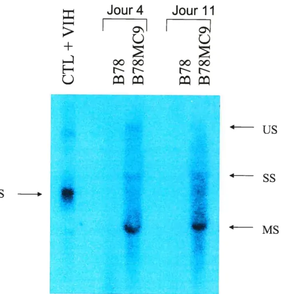 Figure 4 Détection de l’ARN du VIH dans les cellules B78MC9 infectée par le VSV-G/NL4