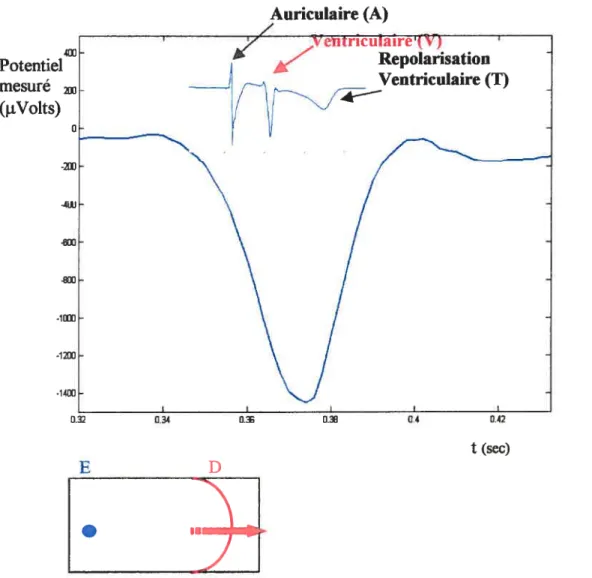 Figure 1.3 Forme d’onde monophasique (variations temporelles du potentiel électrique cardiaque) d’une activation ventriculaire mesurée par une électrode unipolaire auriculaire épicardique.