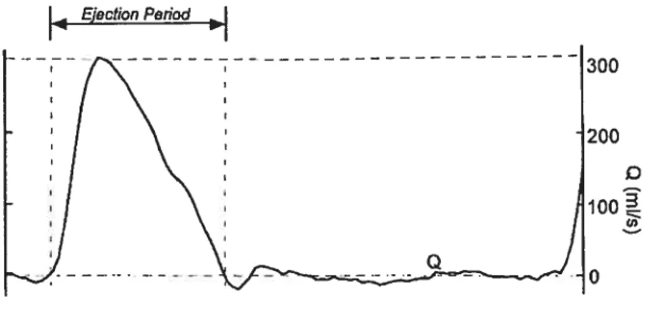 FIG. 2.2 — Forme typique du débit transvalvulaire aortique. La période d’éjection