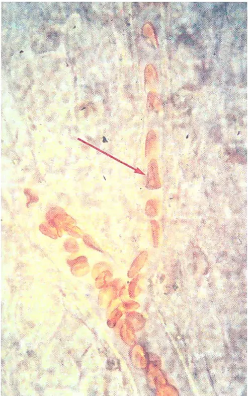 FIG. 1.8 — Aux bifurcations, les agrégats de globules rouges se défont, tandis que les érythrocytes se déforment dans les microvaisseaux, d’après [72j.