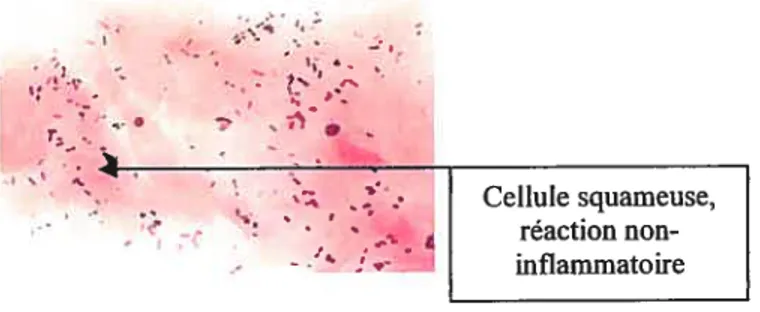 Figure 9: Exemple d’un spécimen non-valable. Frottis représentant