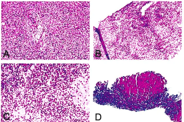 Figure 2: Images d’un foie normal et de foies atteints par I’HAI. A, section d’une région périportale d’un foie normal (hématoxyline et éosine, x 100)