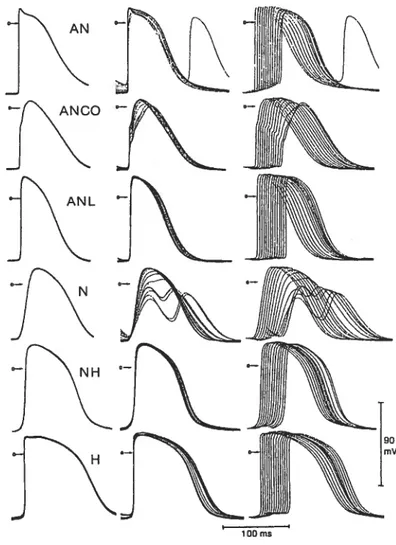 figure 4 Potentiels transmembranaires du noeud AV à différents degrés de