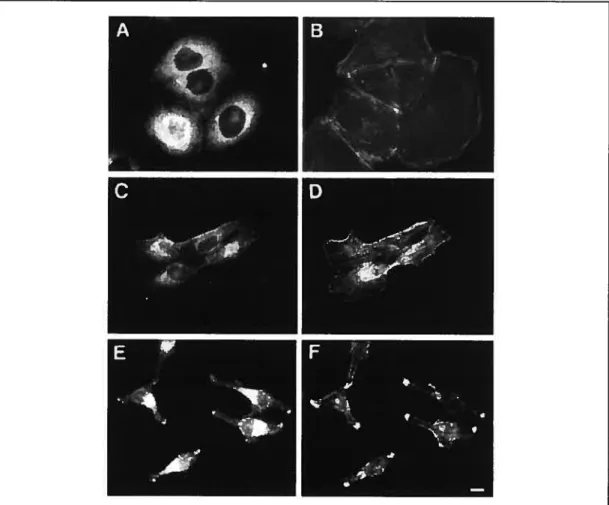 Figure 1.10: NHE 1 is localized to f-actin-rfch pseudopodia in MSV MDCK-INV ceils. (A,B) MDCK, (C,D) MSV-MDCK and (E,F) MSV MDCK-INV ccli unes were immunofluorescentiy labeled with polycional anti-NHEY (A,C,E) and monoclonal anti-13-actin (B,D,F) antibodie