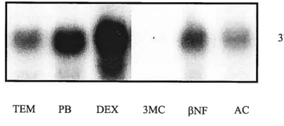Figure 6. Représentation de l’analyse par Northern Blot de l’influence d’une administration en dexaméthasone (DEX), phénobarbital (PB), 3-méthyÏchloranthrène  (3-MC), beta-naphtoflovavone (f3NF) et acétone tAC) sur l’expression génique du CYF3A4 chez des a