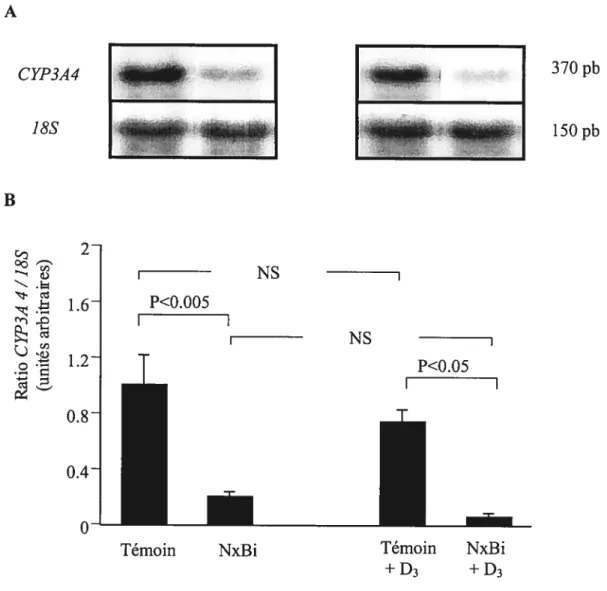 Figure 7. Effet de l’IRA sur l’expression génique du CYP3A4 hépatique chez des animaux Ca-D- et Ca-D- supplémentés en dose aiguê de vitamine D3 (250.Ig.kg) 5 heures avant sacrifice