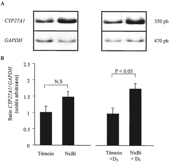 Figure 9. Effet de l’IRA sur l’expression génique du CYP27A1 hépatique chez des animaux Ca-D- et Ca-D- supplémentés en dose aiguê de vitamine D3 (250ig.kg’), 5 heures avant sacrifice