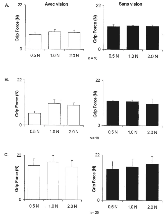 Figure 29: Synthèse de la performance motrice (application de la force perpendiculaire durant la phase de maintien) de la patiente GL, avec vision (blanc) ou sans vision (noir) et les trois textures, soit le papier émeri (A), la surface métallique (B) et la surface Tekscan