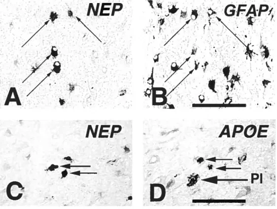 Figure 2.4: Presence of Neprilysin in reactive astrocytes in AD. Co-localization (thin arrows) of Neprilysin (A) and GFAP (B) on adjacent sections from a hippocampal region with senile plaques