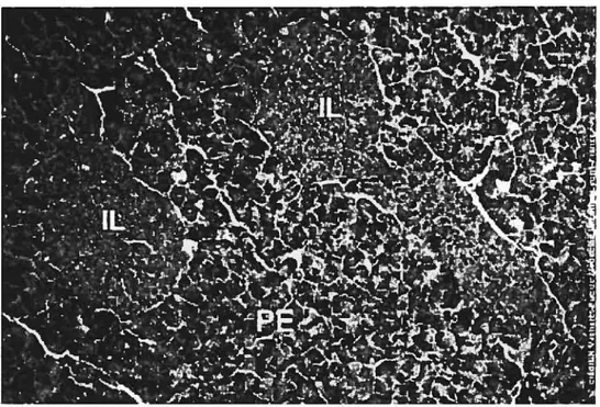 Figure 3: Le pancréas: une glande endocrine et exocrine. La figure montre le parenchyme exocrine (PE) formé d’acini et deux volumineux ilots endocrines ou îlots de Langerhans (IL)