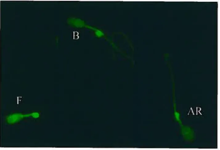 Figure 8: Profils de fluorescence des spermatozoïdes colorés au CIC. Spermatozoïde normal (F), Spermatozoïde capacité (B), Spermatozoïde acrosome réagi (AR)