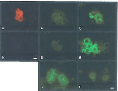 Fig. 10. Visualization of GHRH-R in semi-purified HL celis with the anti GHRH-R(392-404) antibody and Fluo-GHRH