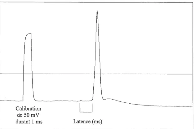 Figure 3.1 Un potentiel d’action antidromique précédé par une calibration de 50 mV durant 1 ms