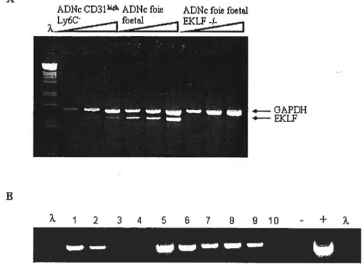 Figure 6: Expression de EKLf dans les cellules enrichies en progéniteurs